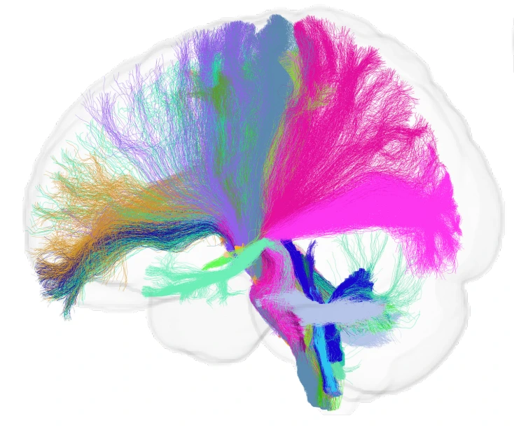Colorful tractography pathways connect regions of the brain and extend into the brainstem.